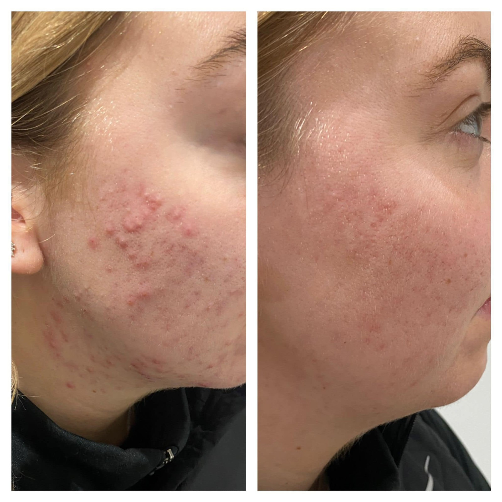 The One Lounge One Lounge News 3 Reasons Why You Should Stop